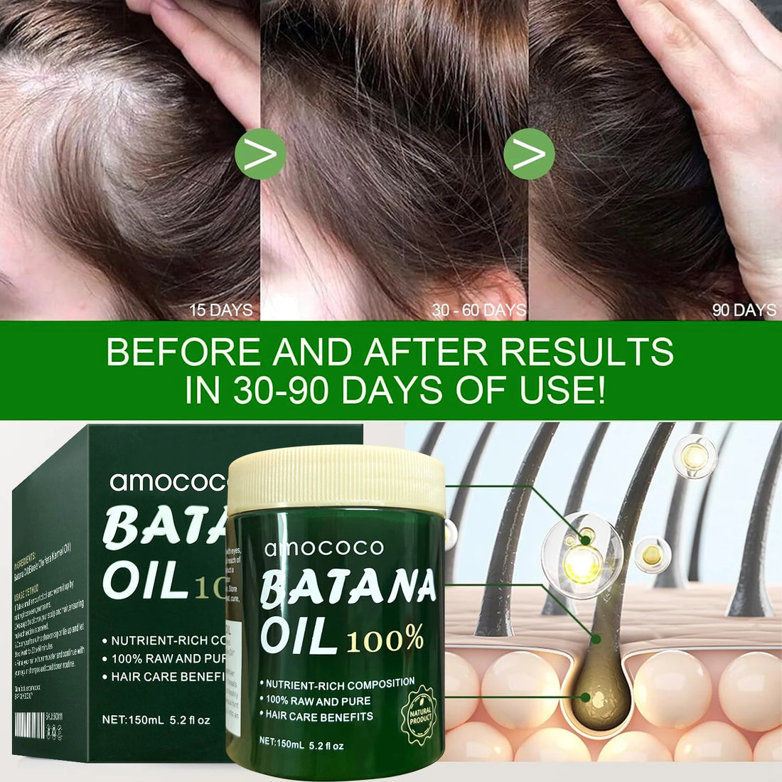 Amococo 2pcs Batana Oil 100% 150ml Each Pure Natural Hair Oil Treatment Nourishing Moisturizing Repair Care for Dry Damaged Hair Strengthening Conditioner for Women Men
