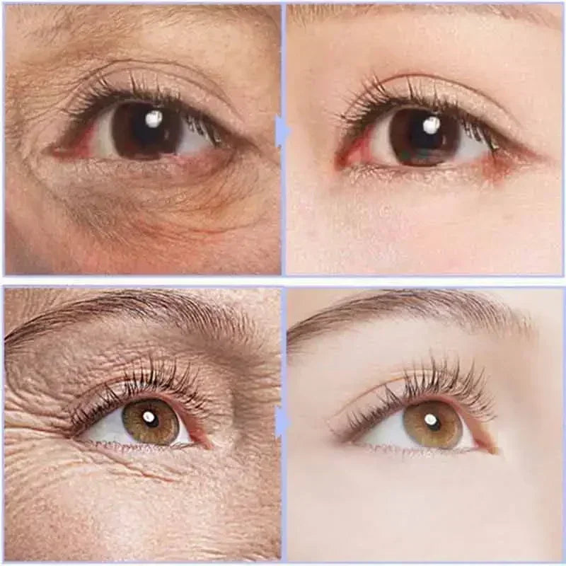Instant Eye Cream For Anti Aging Dark Circles Bags Puffiness Great Under Eye Skin Face Tightening Eye Lift Treatment Care Halalzen