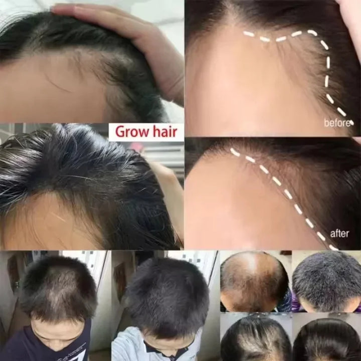Fast Hair Growth Cream Anti Hair Loss Prevent Baldness Scalp Treatment Repair Roots Beauty Health Hair Care For Men Women