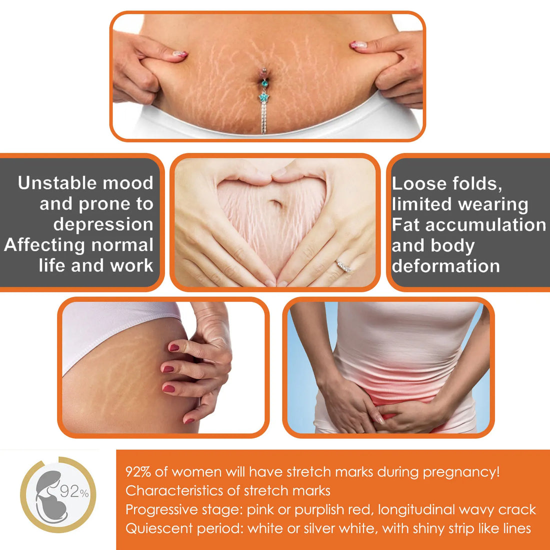 100g Stretch Marks Redece Cream Maternity Pregnant Women Pregnancy Faded Winkle Smooth Repair Firming Skin Body Care Product