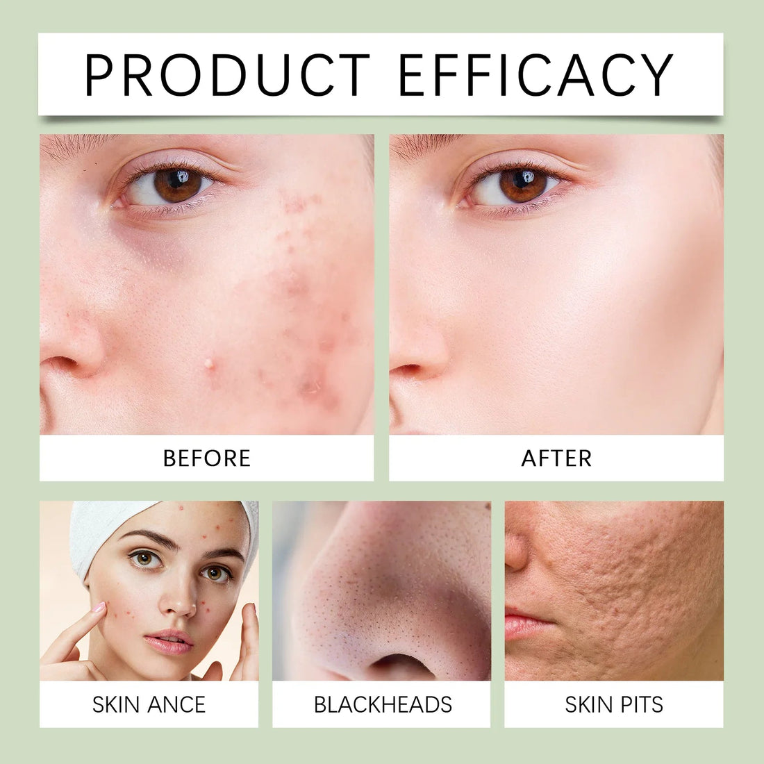 Green Tea Salicylic Acid Facial Cleanser Gently Clean Pores Moisturize Without Tightening Improve Acne Cleanse Refresh Care Halalzen