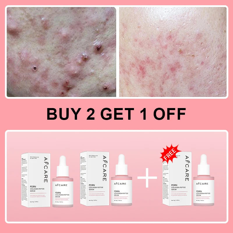 Collagen Peptide Facial Serum Targets Dull Skin Boosts Skin Elasticity Stimulates Skin Renewal Repair Salmon PDRN KOREAN Product Halalzen