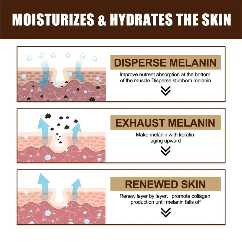 Powerful Spot-removing Whiten Serum Cream Vitamin C Skin Brighten Essence Removal Melasma Dark Spots Moisturize Beauty Skin Care