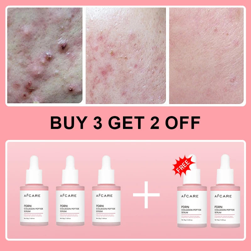 Collagen Peptide Facial Serum Targets Dull Skin Boosts Skin Elasticity Stimulates Skin Renewal Repair Salmon PDRN KOREAN Product Halalzen