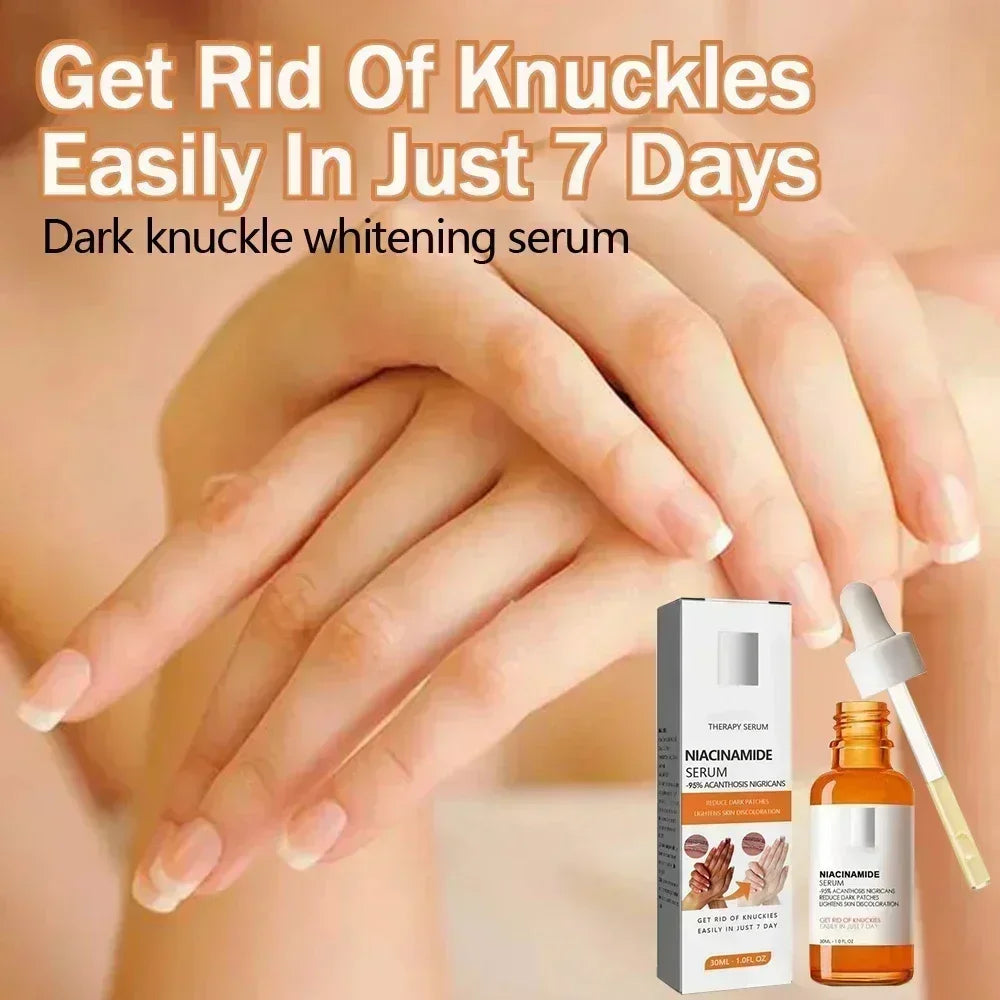 Dark knuckles whitening serum Elbows Armpit Beaching SerumWoman Private Part Skin Removal Dark Knuckles Strong Whitening Serum Halalzen
