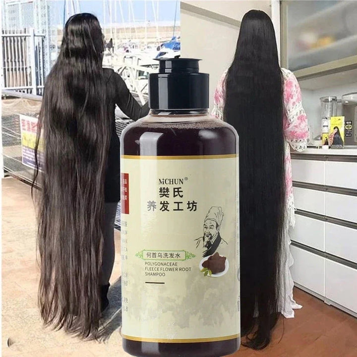 300ml Africa Women Traction Alopecia Treatment Hair Growth Product for Men Shampoo Hair Loss Treatment Get Rid of Wigs