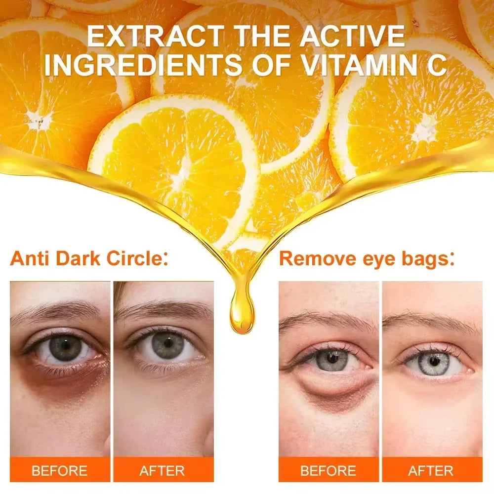 Anti Dark Circle Eye Serum Oil Retinol Anti Wrinkle Firming Skin Remove Eye Bag Fade Fine Line Whitening Brighten Eye Care Korea Halalzen