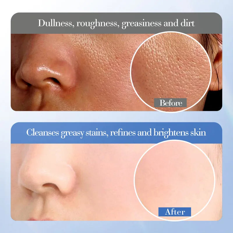 SADOER White Rice Nicotinamide Whitening Facial Cleanser Moisturizing Anti-Aing Anti Wrinkles Face Wash Foam Cleanser Skin Care Halalzen