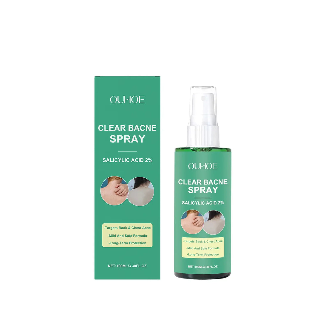 Back Acne Treatment Spray Anti Marks Spot Moisturizing Repairing Soothe Oil Control Shoulder Breast Body Pimples Remover Spray