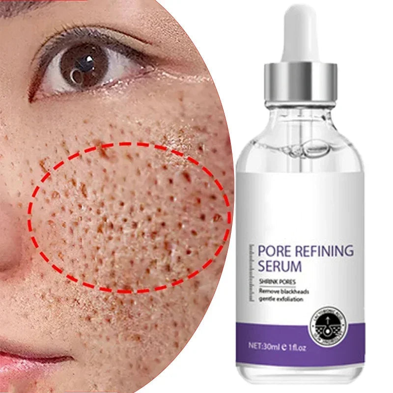 Skin Texture | Pore Refining Resurfacing, Brightening Facial Serum with Retinol and Niacinamide Non-Comedogenic Halalzen