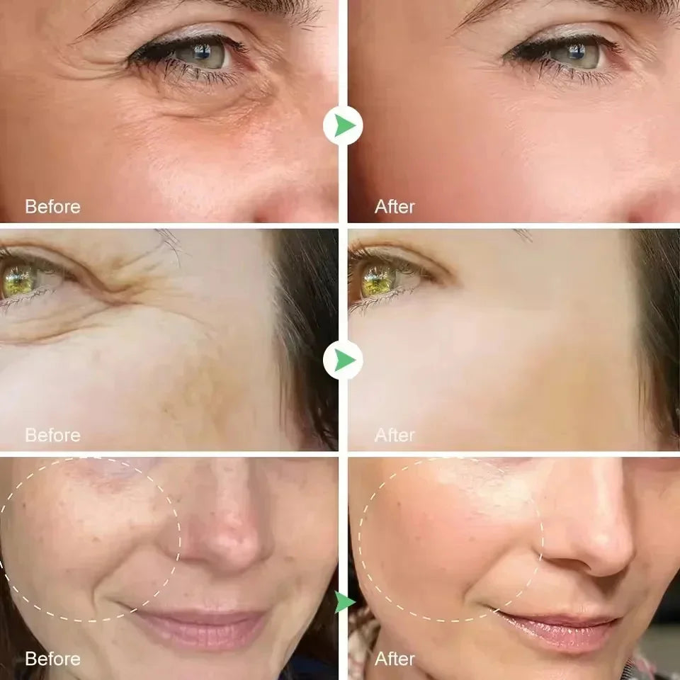 Facial Retinol Serum Whitening Moisturising Fade Fine Lines Anti Wrinkle Anti Ageing Rejuvenate Your Face Korean Cosmetics 30ml Halalzen