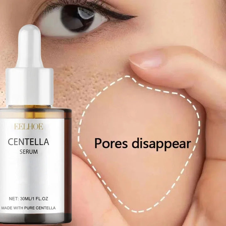 Centella Asiatica Face Serum Nourish Dry Skin Smoothing Rejuvenation Skin Brightening Whitening Cream Facial Moisturizer Korean Halalzen
