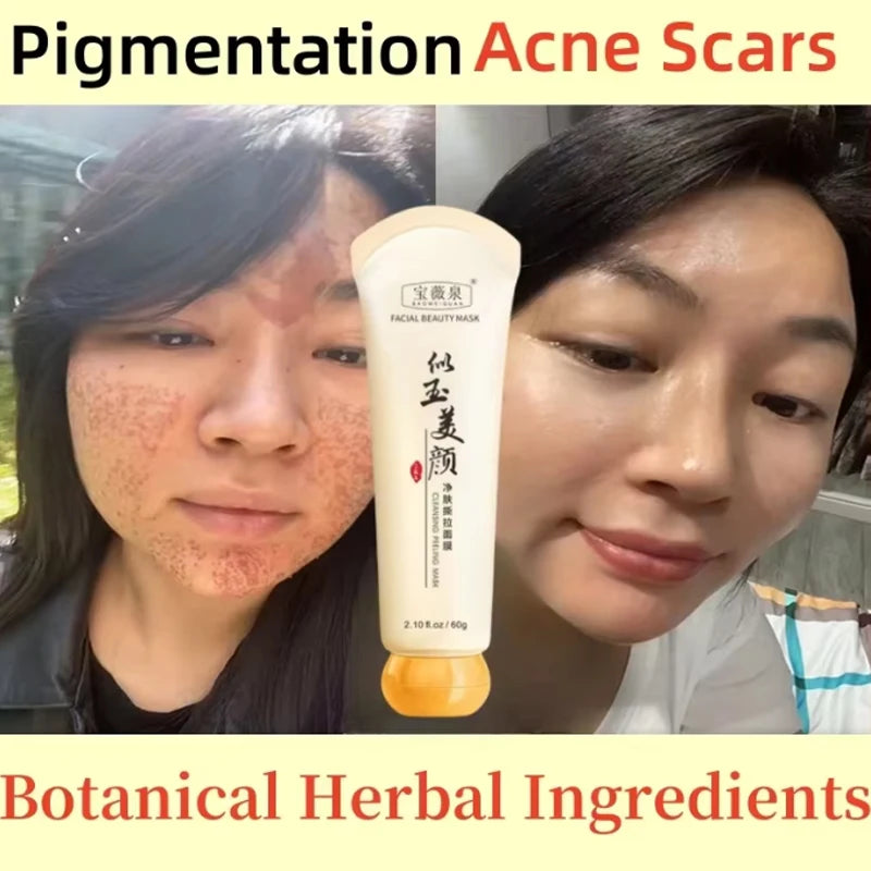 Peel Off Instant Freckle Removal Mask Effective Treatment Chloasma Pigmentation Acne Scars Dark Spots Facial Skin Care Products