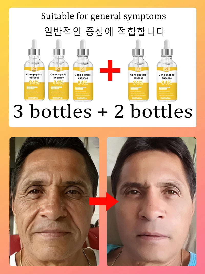 Peptide Facial Essence Serum Hyaluronic Acid Collagen Blend Deep Hydration Skin Elasticity Care Daily Beauty Treatment