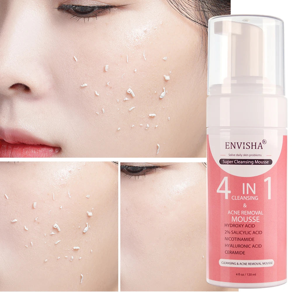 ENVISHA Facial Skin Care Exfoliating Mousse Peeling Gel Deep Remove Cleaning Smooth Moisturizing Cream Whitening Shrinking Pores Halalzen
