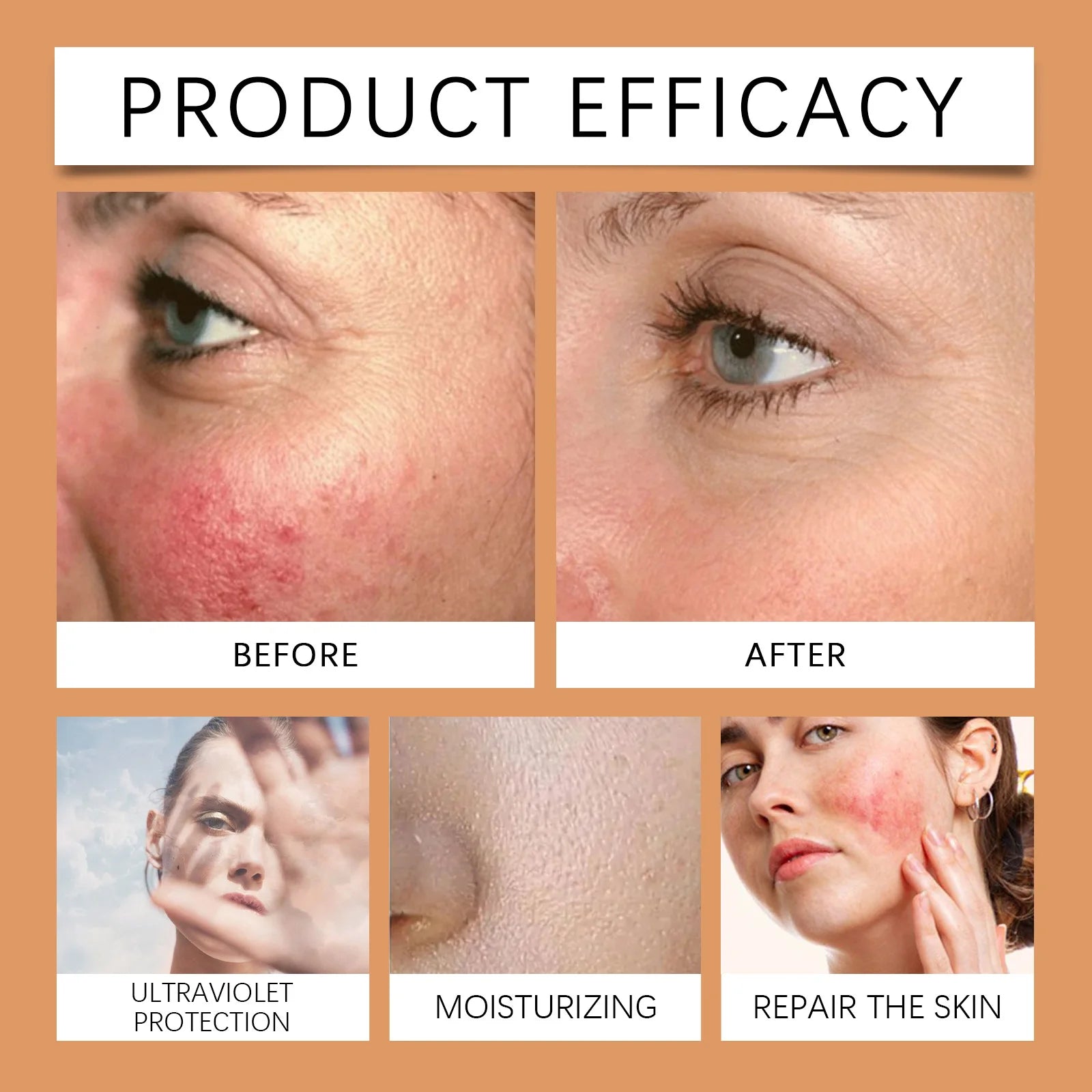 EELHOE 30g Vitamin E Sunscreen Long-lasting Moisturizing Anti-UV Anti-dry Skin SPF 50 Cream Maintains Elasticity Glow Skin Care Halalzen