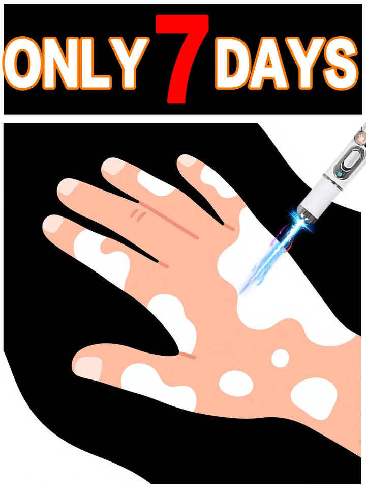 Blue light pen quickly removes vitiligo, a best-selling vitiligo care tool. Halalzen