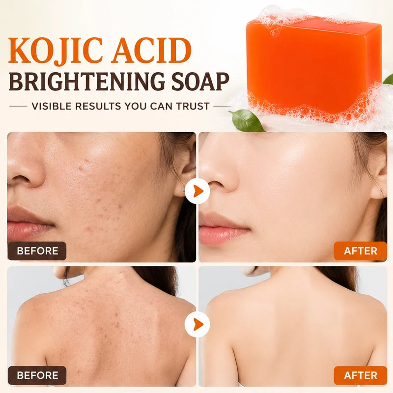 Kojic Acid Soap 6 Pack Brightening and Deep-Cleansing Purifying Face Body Bar Evens Skin Tone Smooths Moisturizes Dull Skin 65g Each