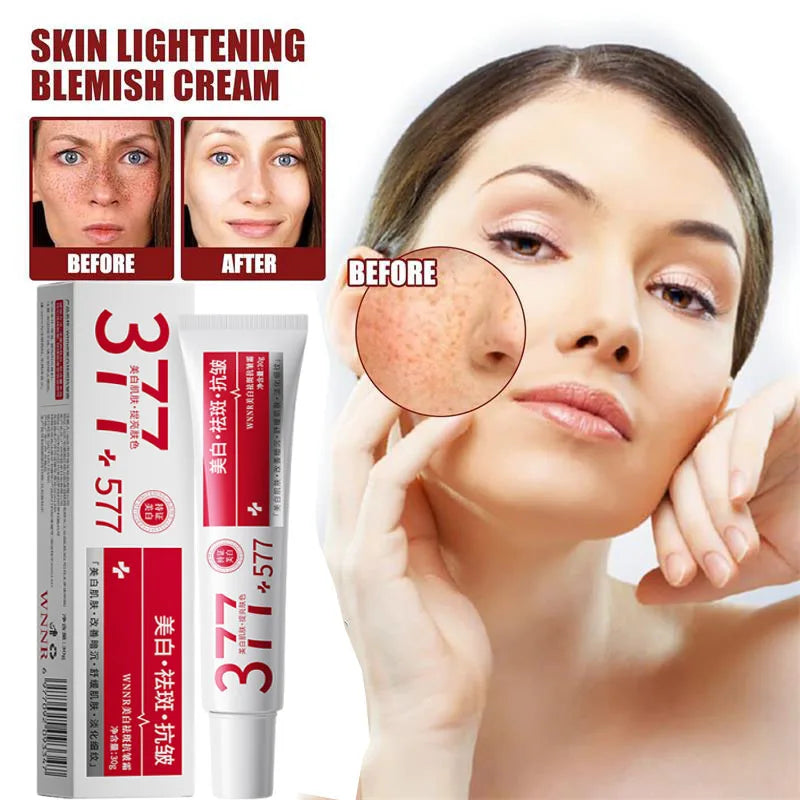 Powerful Spot-Removing Whiten Cream Brighten Skin Fast Eliminates Melanin Pigmentation Melasma Dark Spots Korean Face Skin Care