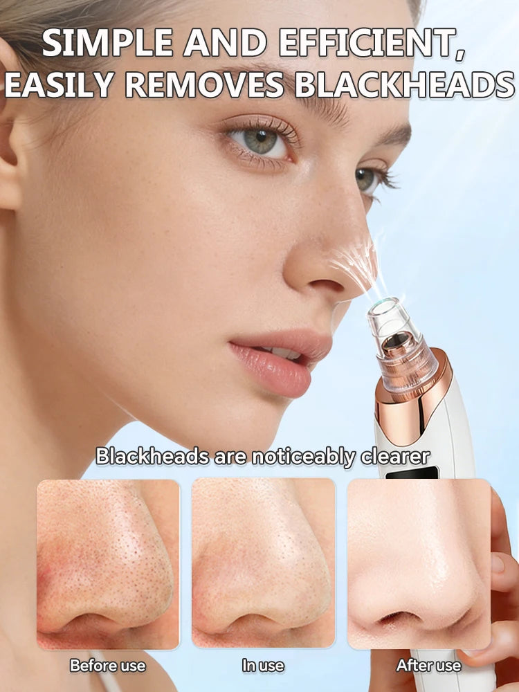 Electric Blackhead Remover Vacuum Pore Cleaner Deep Facial Cleaning Device Nose Suction Tool Skin Care Beauty Machine
