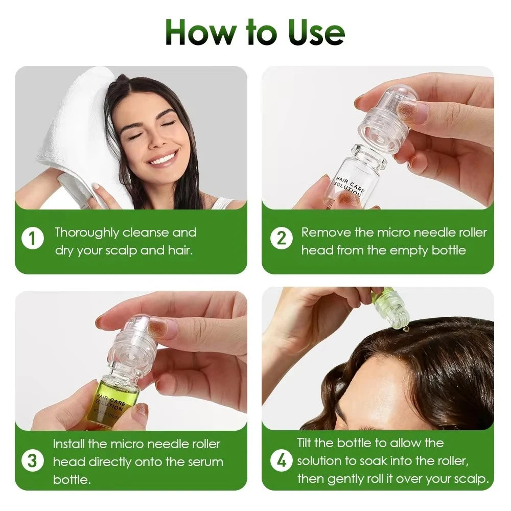 0.25mm Scalp Micro‑Needle Roller Set with 8×5ml Ampoules Nourish Follicles Reduce Loss & Breakage Boost Scalp Density