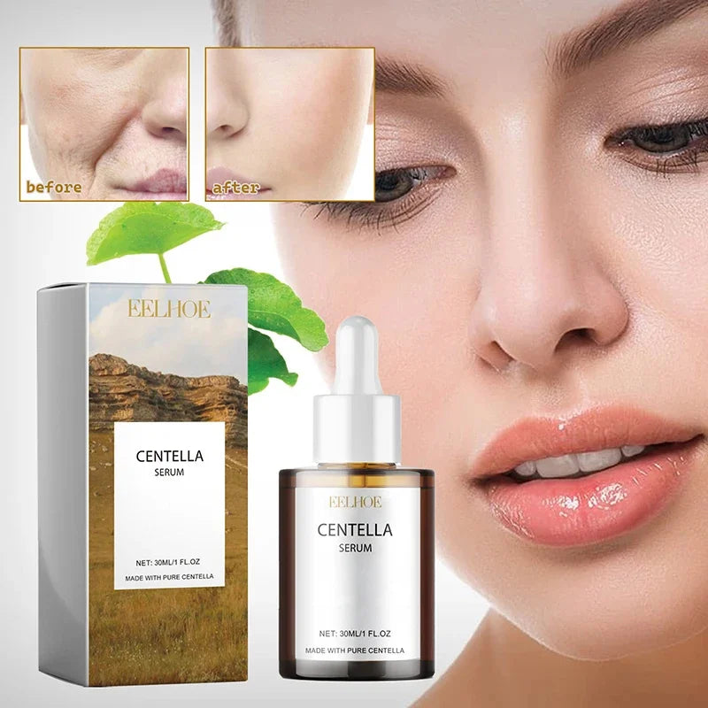 Centella Asiatica Face Serum Nourish Dry Skin Smoothing Rejuvenation Skin Brightening Whitening Cream Facial Moisturizer Korean Halalzen