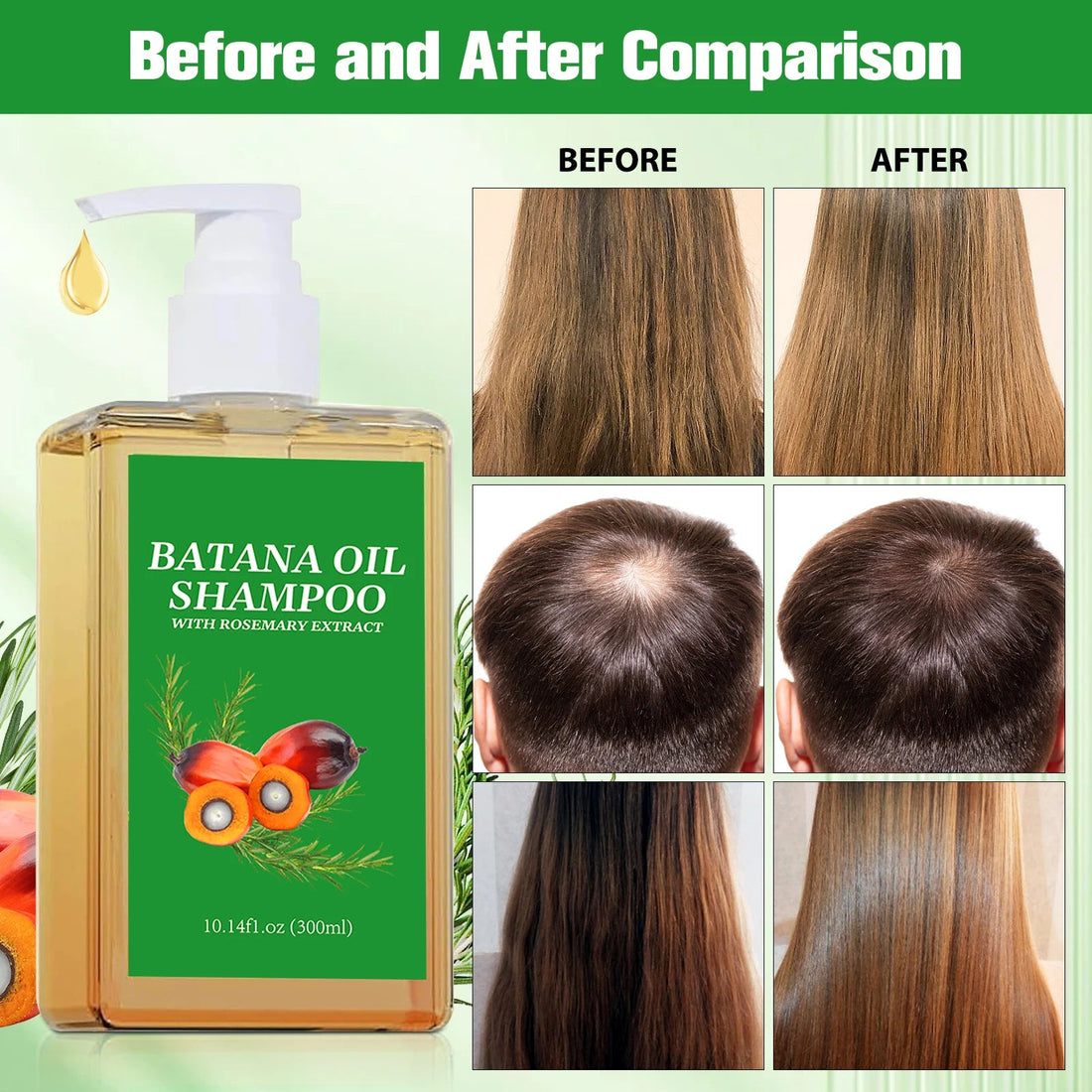 Batana Oil Shampoo & Conditioner Set Hair Strengthens Anti Loss Restore Damaged Cleansing Dandruff Control Hair Growth Shampoo Halalzen
