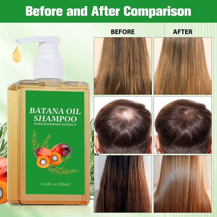 Batana Oil Shampoo & Conditioner Set Hair Strengthens Anti Loss Restore Damaged Cleansing Dandruff Control Hair Growth Shampoo Halalzen