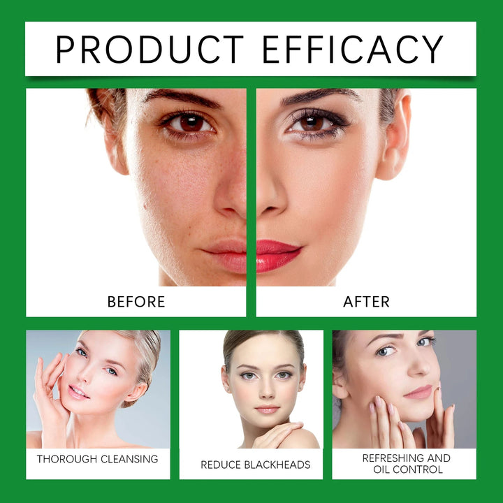 Aloe Cleansing Foam Gently Cleanses The Face Deeply Hydrates Pores Controls Oil Moisturizes And Is Comfortable Without Tightness Halalzen