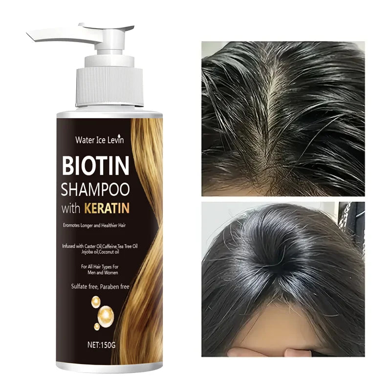 Water Ice Levin Biotin Keratin Shampoo – Strengthens Hair, Boosts Health Deep Moisture, Thorough Cleansing. All Hair Types. Halalzen