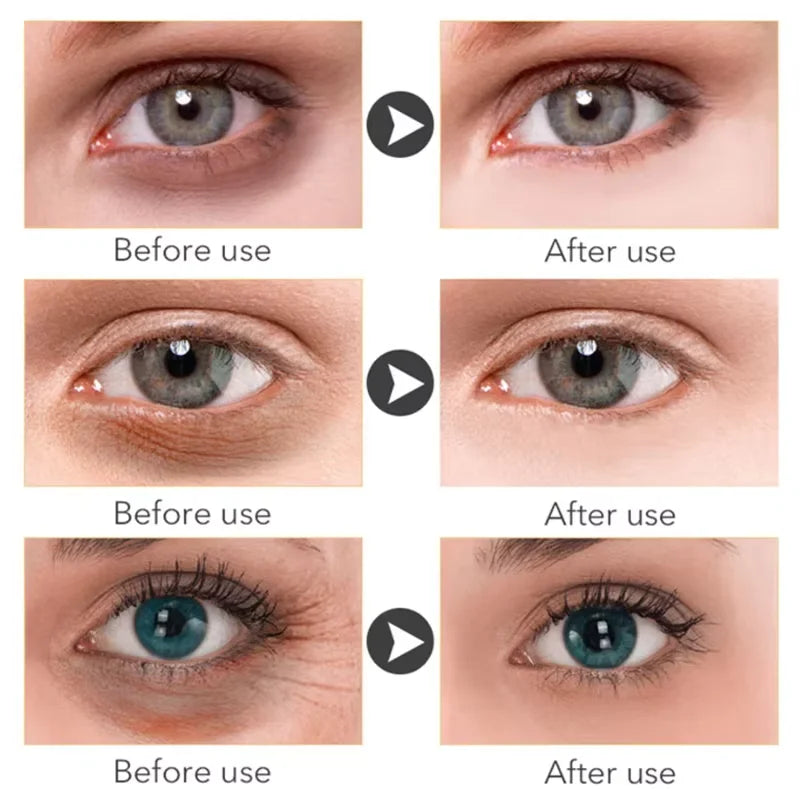 Anti Dark Circle Eye Serum Oil Retinol Anti Wrinkle Firming Skin Remove Eye Bag Fade Fine Line Whitening Brighten Eye Care Korea Halalzen