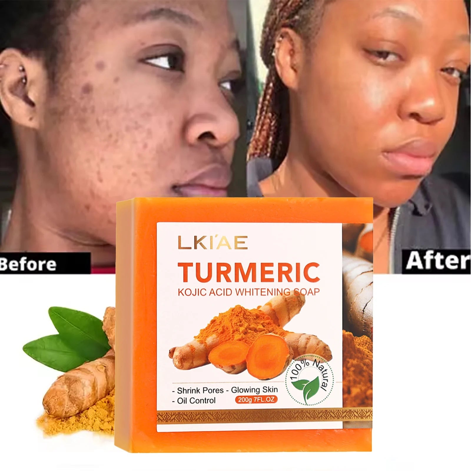 Natural Turmeric Whitening Body Wash, Deeply Clean Skin, Remove Dark Spot, Pimple, Acne, Smooth Skin, For Face & Body Soap Bar Halalzen