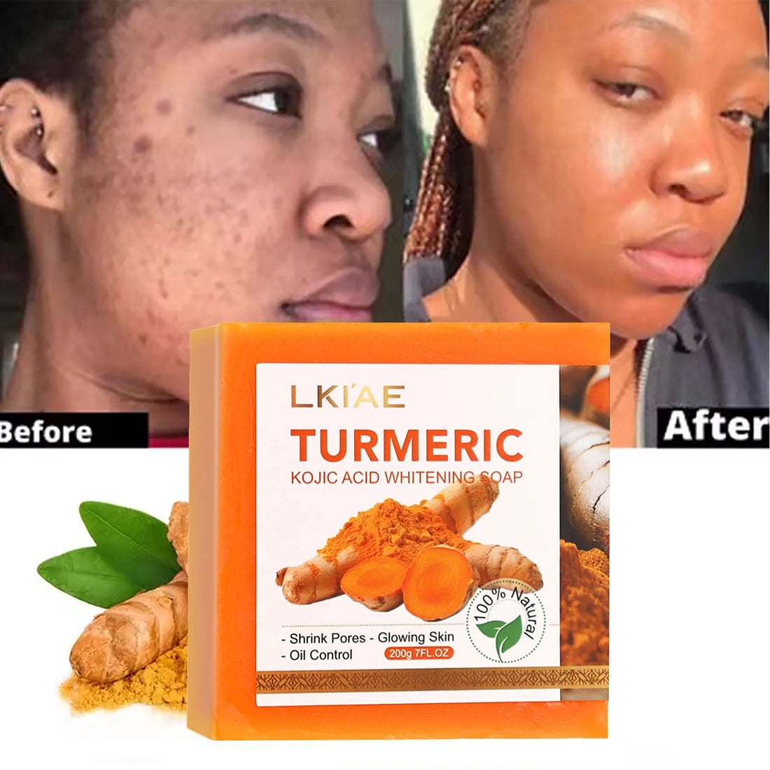 Natural Turmeric Whitening Body Wash, Deeply Clean Skin, Remove Dark Spot, Pimple, Acne, Smooth Skin, For Face & Body Soap Bar Halalzen