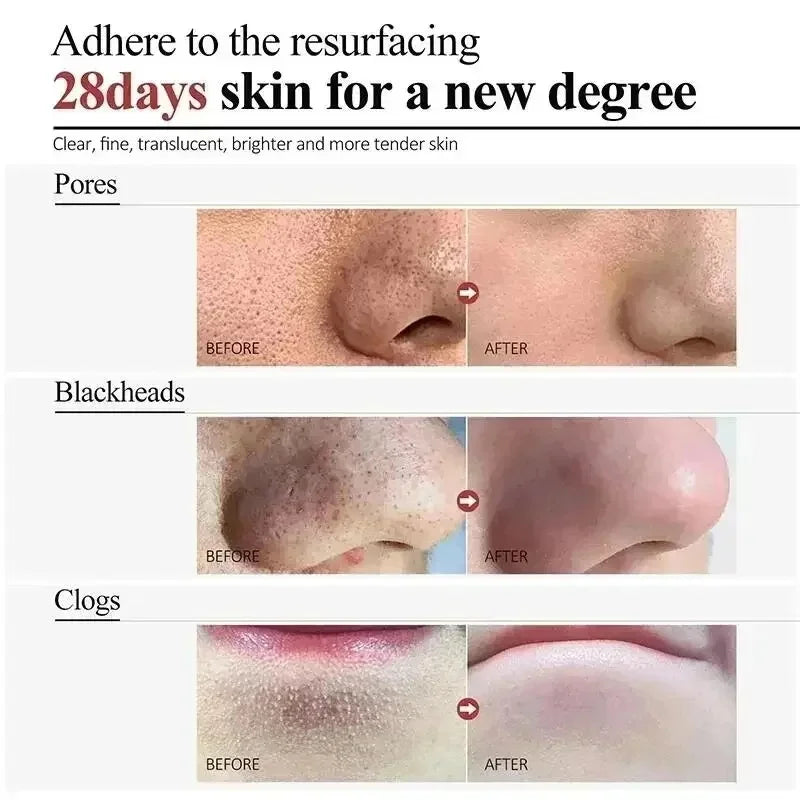 Centella Clay Mud Stick Mask Pore Minimizing Quick Shrink Pores Remove Blackheads Acne Scars Moisturizing Brighten Korean Makeup