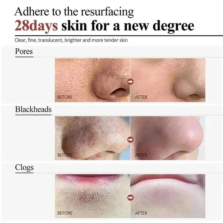 Centella Clay Mud Stick Mask Pore Minimizing Quick Shrink Pores Remove Blackheads Acne Scars Moisturizing Brighten Korean Makeup
