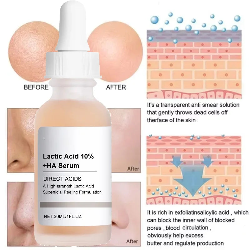 Large Pore essence Lactic Acid Facial Pore Shrinking Product Pore Firming and Smooth Korean Skin Care Halalzen