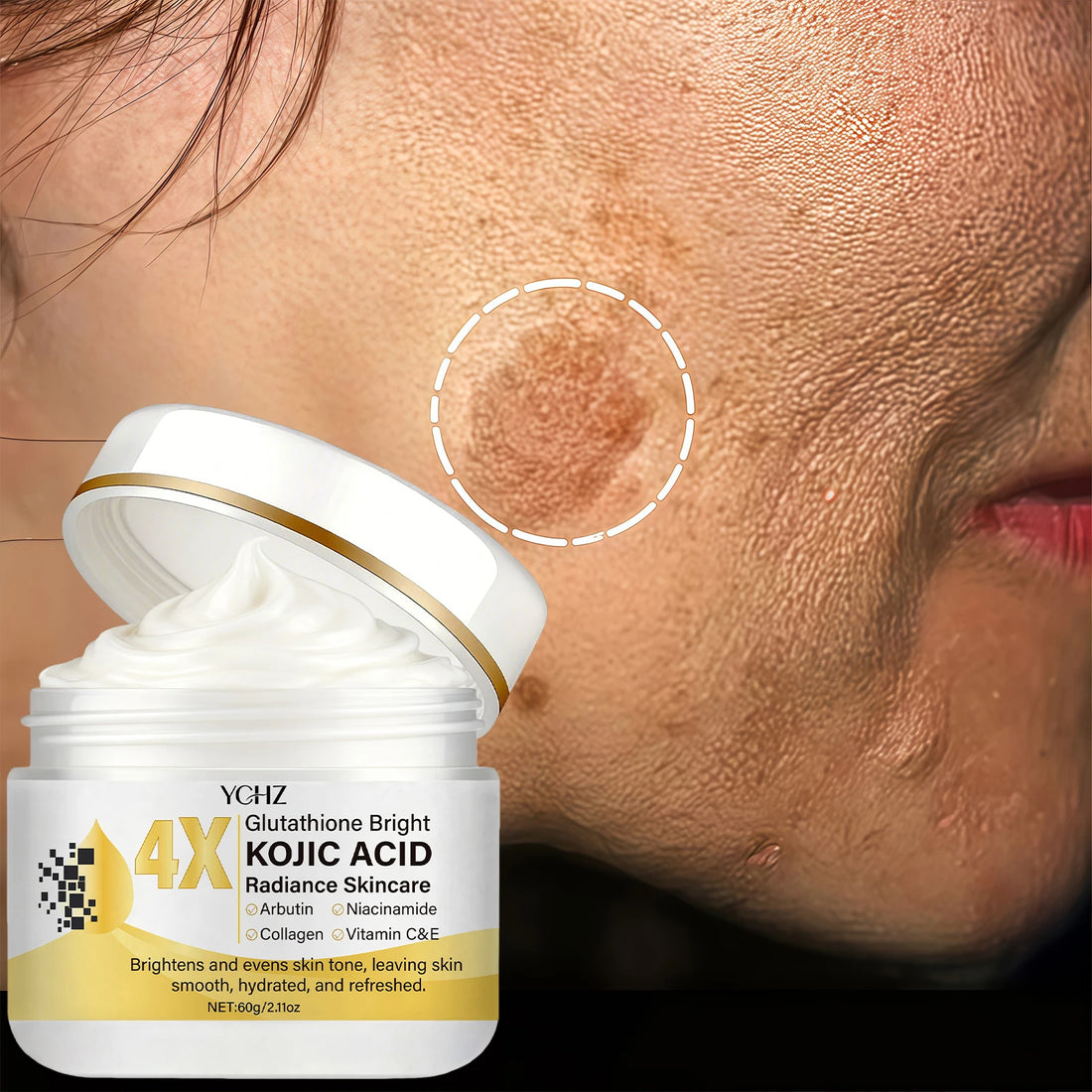 Kojic Acid Cream, Evens Out Skin Tone, Eliminates Dark Spots and Dullness - Non-Greasy, Suitable for Both Men and Women - Whitening and Moisturizing Cream, for Day and Night Use - 60g