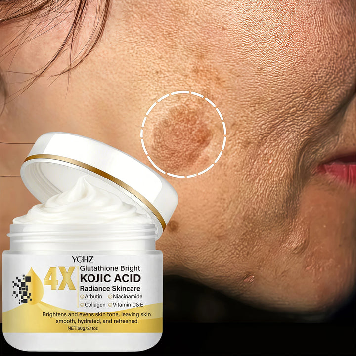 Kojic Acid Cream, Evens Out Skin Tone, Eliminates Dark Spots and Dullness - Non-Greasy, Suitable for Both Men and Women - Whitening and Moisturizing Cream, for Day and Night Use - 60g