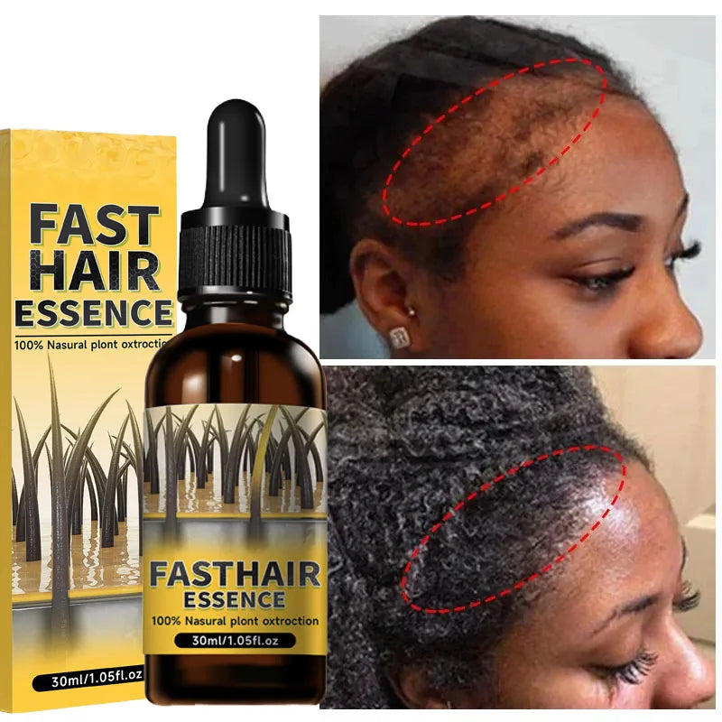 Hair growth plant essence oil beauty care anti hair loss essence natural repair damaged hair HALALZEN