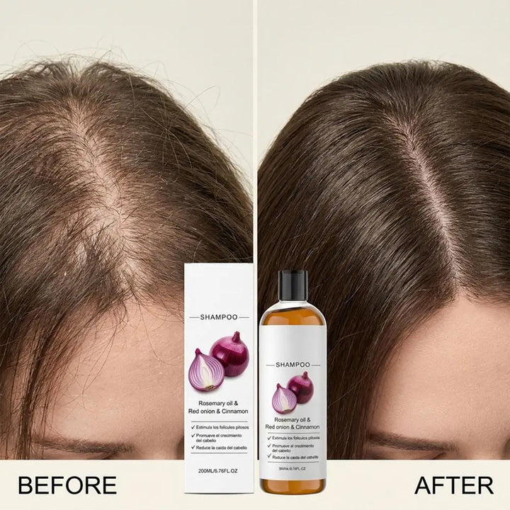 Rosemary Red Onion Cinnamon Shampoo,Anti Hair Loss Treatment for Thicker Stronger Hair, Scalp Nourishing Volumizing Care 200ml