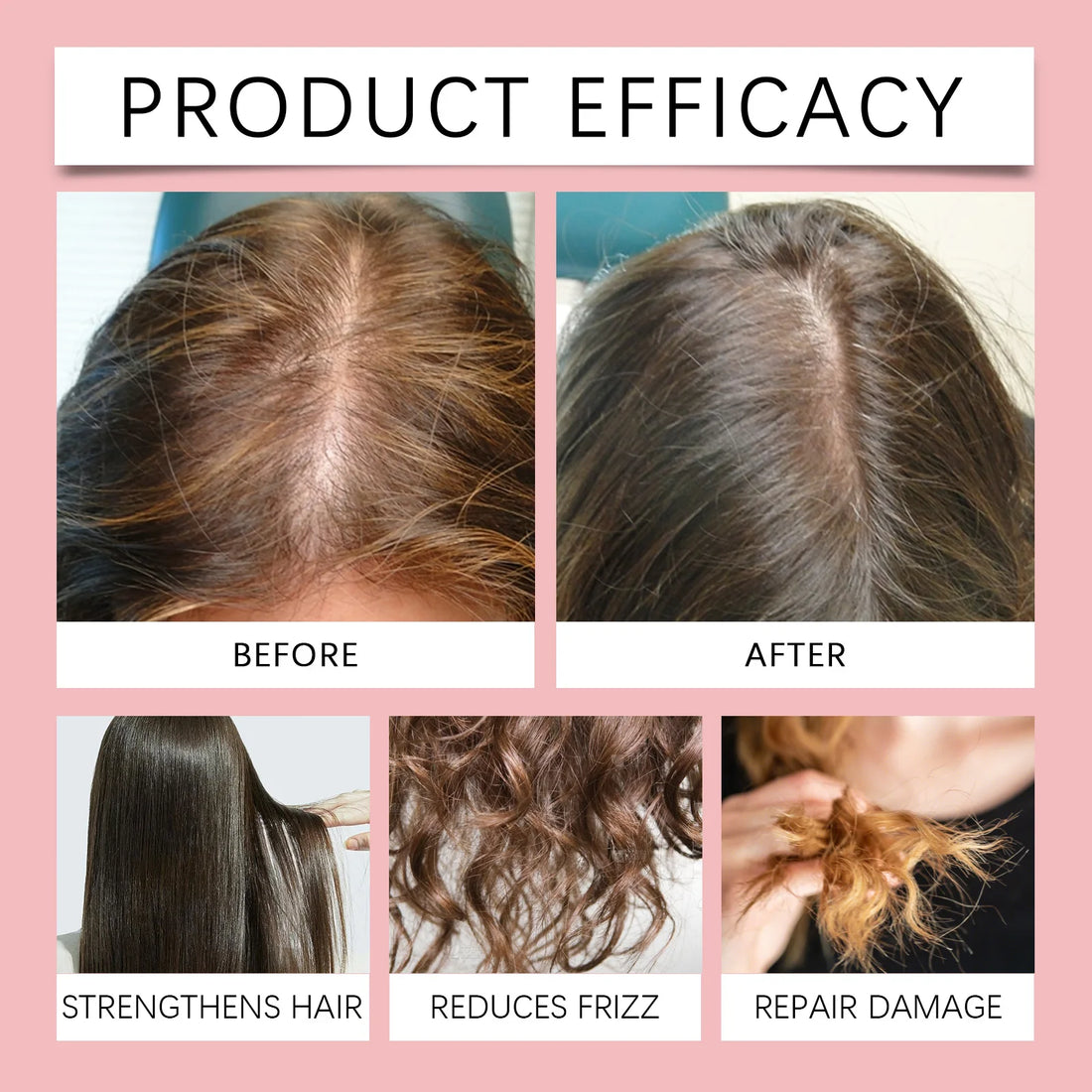 Fermented Rice Water Hair Growth Essential Hair Re-g-rowth Oil Scalp Treatment Hair Fall Control Serum Plant Dense Hair Spray