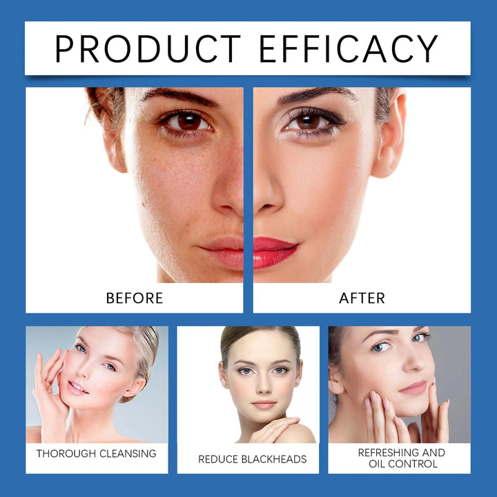 Hyaluronic Acid Cleansing Foam Facial Skin Mildly Cleansing&Attenuating Fine Lines Deep Moisturizing Nourishing Facial Cleanser Halalzen