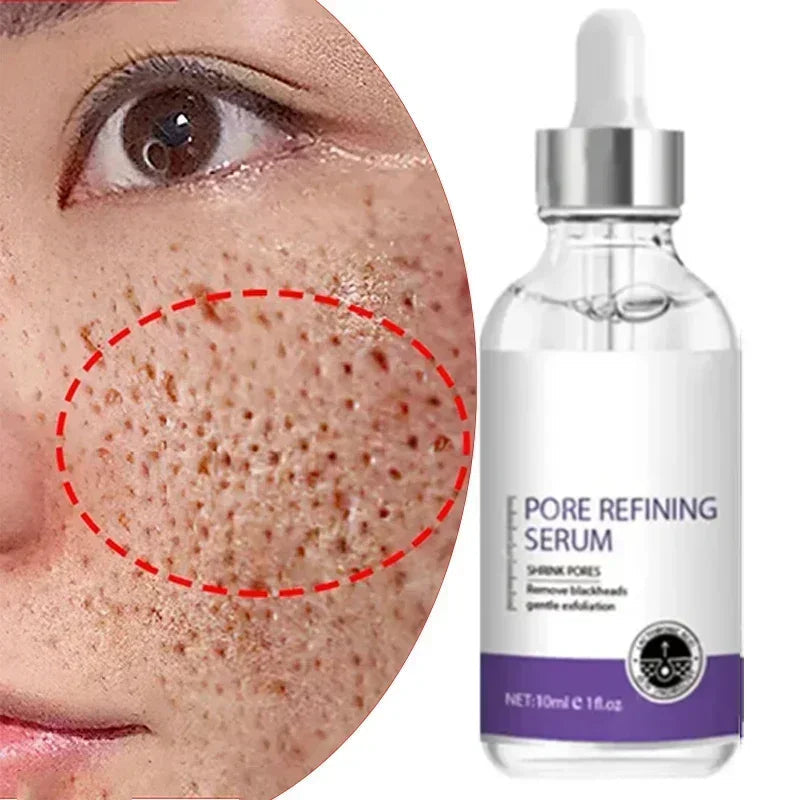 Skin Texture | Pore Refining Resurfacing, Brightening Facial Serum with Retinol and Niacinamide Non-Comedogenic Halalzen