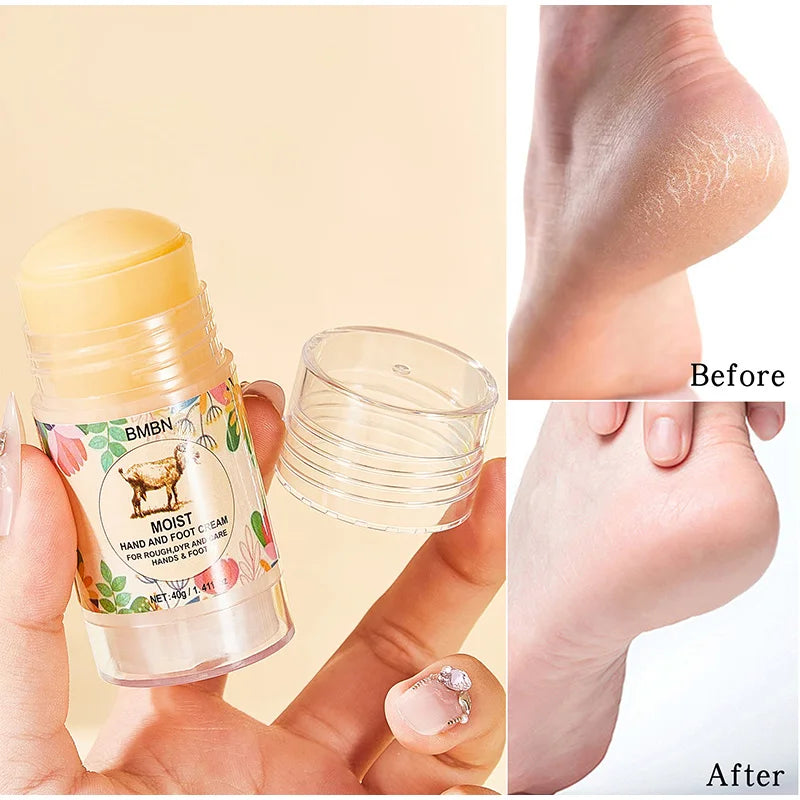 Powerful Repair Hand And Foot Cream,contains Lanolin,hyaluronic Acid, Unisex Moisturizing Cream,for Softening Dry Cracked Skin