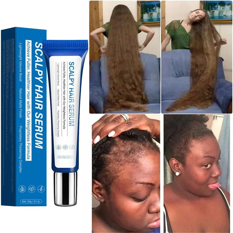 Fast Hair Growth Serum Hair Regrowth Essential Oil Anti Hair loss Repair Damaged Scalp Women Men Anti Baldness Hair Growth Care HALALZEN