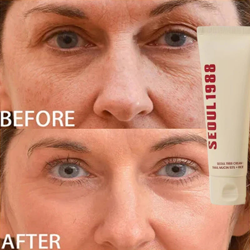 Korean 1988 Retinol Face Care Serum Black Ginseng Niacinamide 2% Acid Moisturizing Firming Cream Anti Aging Wrinkle Skin Care Halalzen