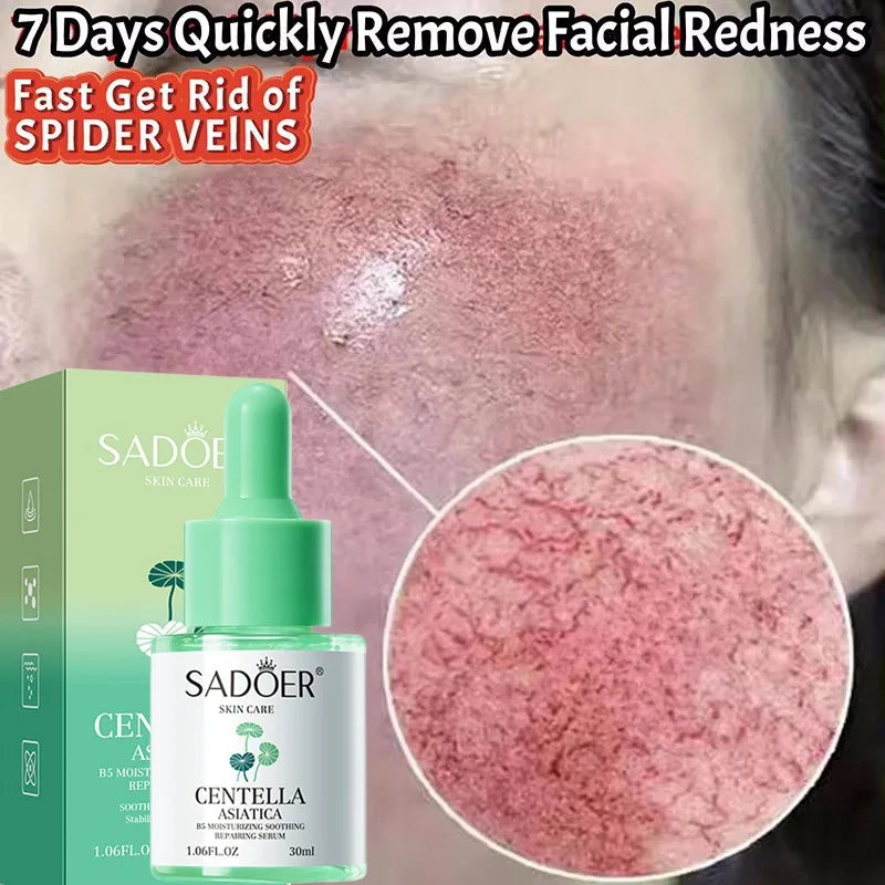 Facial Redness Repair Serum Improve Sensitive Skin Dryness Moisturizer Hydrating Sooth Lotion Removal Rosacea Korean Cosmetics Halalzen